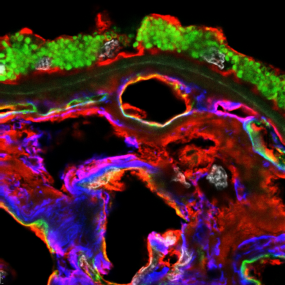 Human Choroid labeled with EBL (a-2,6 sialic acid) in red, anti-CD34 (endothelial cells) in green, anti-Collagen IV (endothelial basement membrane) in blue, and DAPI (nuclei) in white.