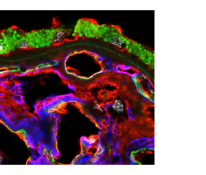 Human Choroid labeled with EBL (a-2,6 sialic acid) in red, anti-CD34 (endothelial cells) in green, anti-Collagen IV (endothelial basement membrane) in blue, and DAPI (nuclei) in white.