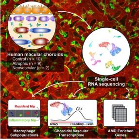 Choroidal Endothelial and Macrophage Gene Expression in Atrophic and Neovascular Macular Degeneration