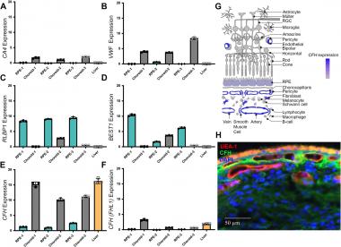 Local factor H production by human choroidal endothelial cells mitigates complement deposition: implications for macular degeneration